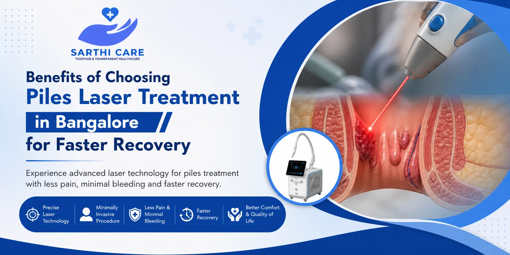 Benefits of Choosing Piles Laser Treatment in Bangalore for Faster Recovery