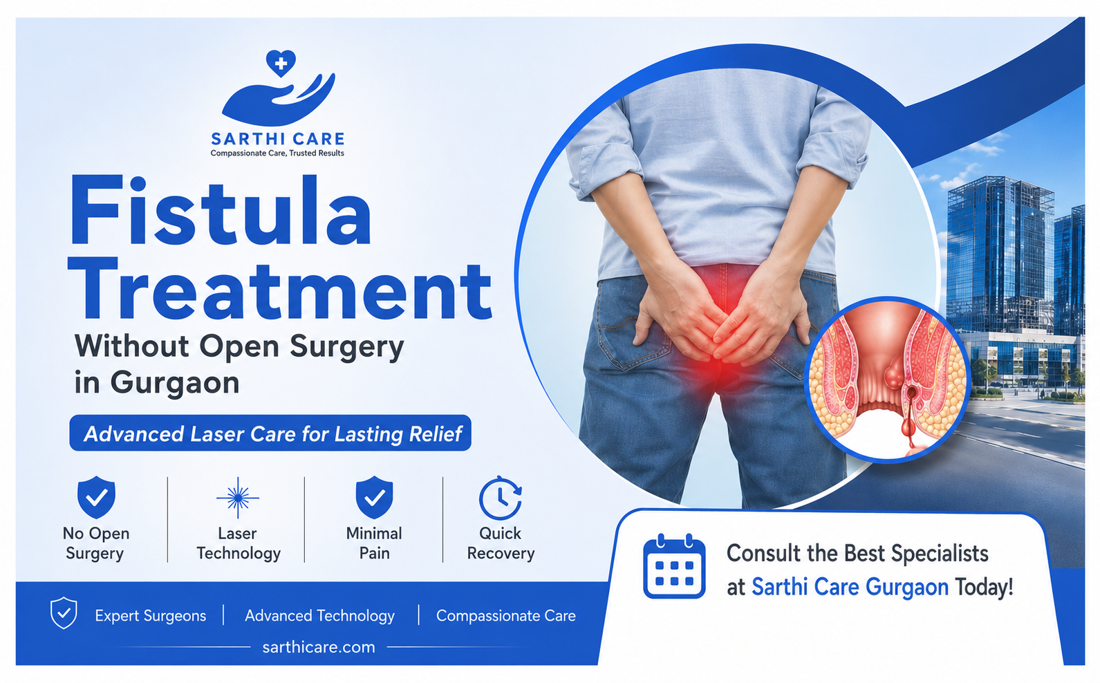 Fistula Treatment Without Open Surgery in Gurgaon